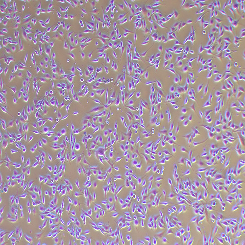 SK-MEL-28人黑色素瘤细胞（STR鉴定正确）