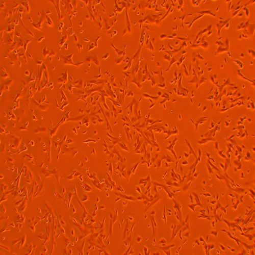 SK-N-SH人神经母细胞瘤细胞（STR鉴定正确）