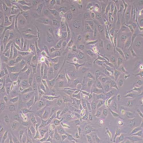 SK-OV-3人卵巢癌细胞（STR鉴定正确）
