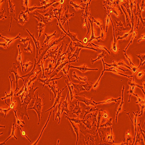 SNB-19人胶质瘤细胞（STR鉴定正确）