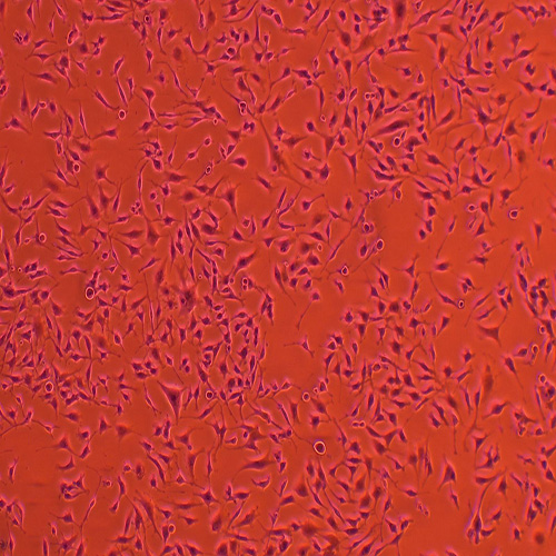 SNB-19人胶质瘤细胞（STR鉴定正确）