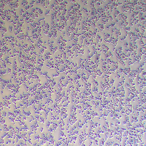 SNU398人肝癌细胞
