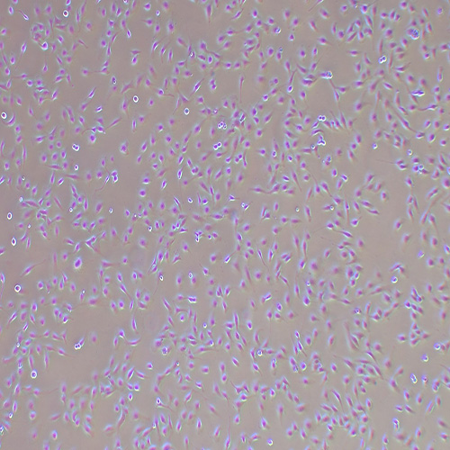 SNU-449人肝癌细胞