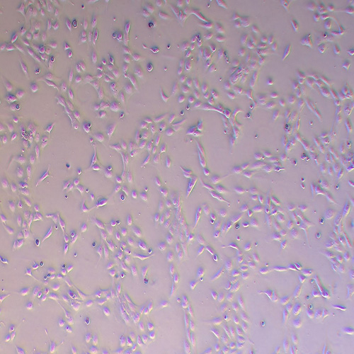 SV-HUC-1人输尿管上皮永生化细胞（STR鉴定正确）