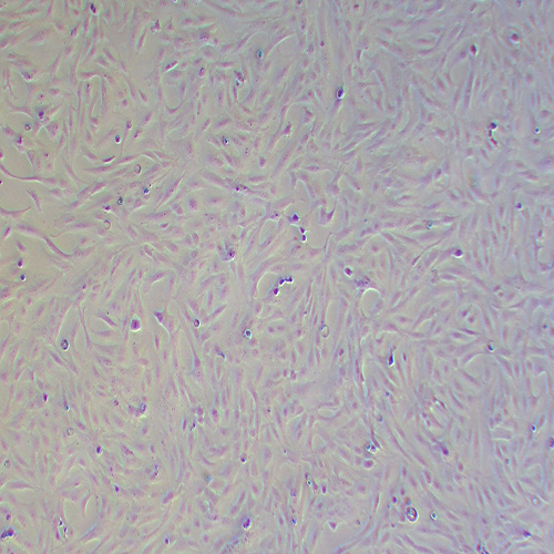 SW 1353人软骨肉瘤细胞（STR鉴定正确）