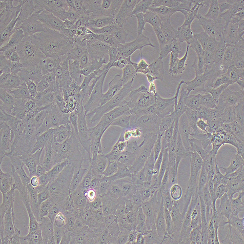 SW 1353人软骨肉瘤细胞（STR鉴定正确）