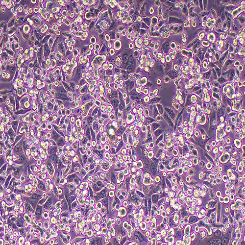 SW480人结肠腺癌细胞（STR鉴定正确）