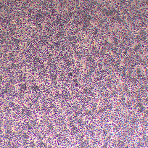 SW480人结肠腺癌细胞（STR鉴定正确）
