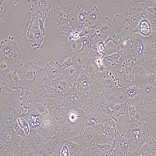 SW-780人膀胱移行细胞癌（STR鉴定正确）
