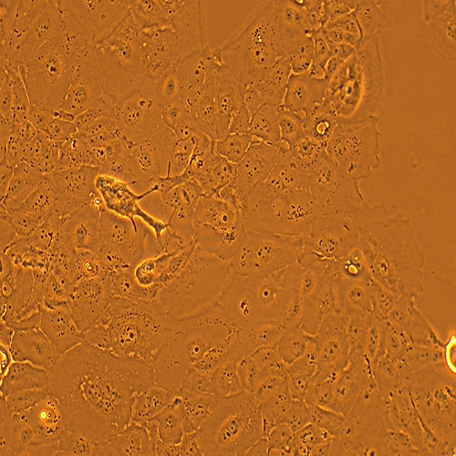 SW1990人胰腺癌细胞（STR鉴定正确）