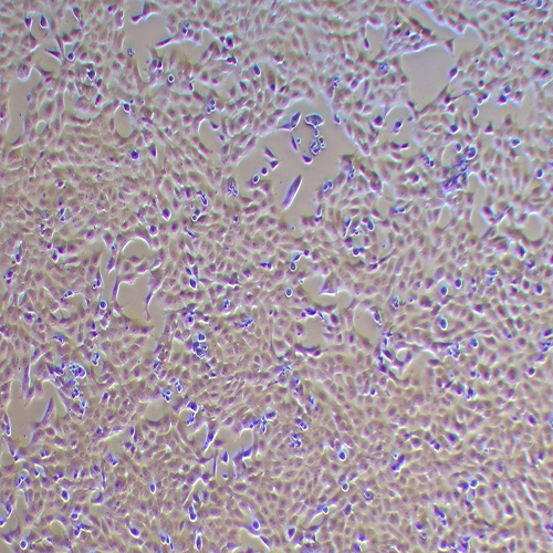 T47D人乳腺导管癌细胞（STR鉴定正确）