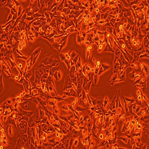 T98G人脑胶质瘤细胞（STR鉴定正确）