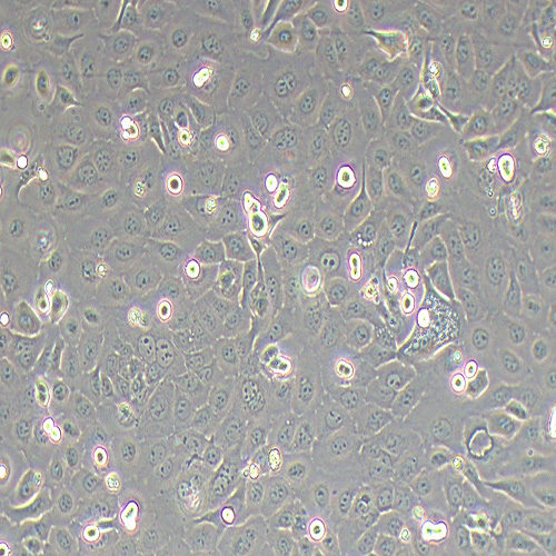 TE-1人食管癌细胞（STR鉴定正确）