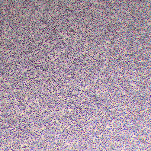 THP-1人单核细胞白血病细胞（STR鉴定正确）