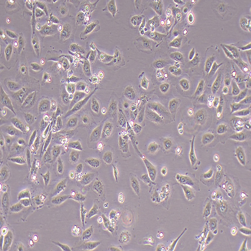 TPC-1人乳头瘤状甲状腺癌细胞（STR鉴定正确）