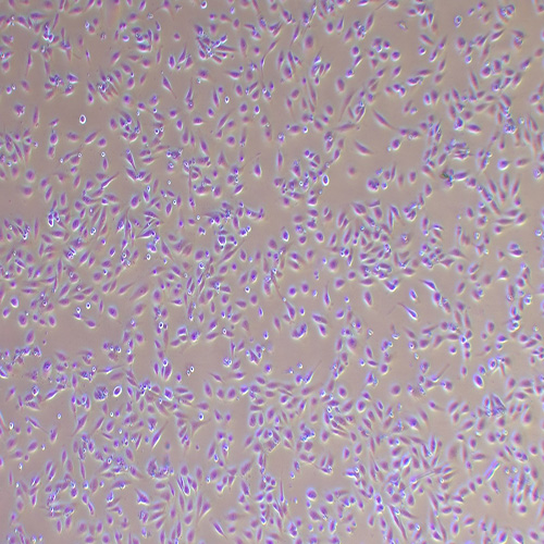 TPC-1人乳头瘤状甲状腺癌细胞（STR鉴定正确）