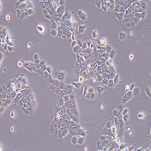 TU212人喉癌细胞（STR鉴定正确）
