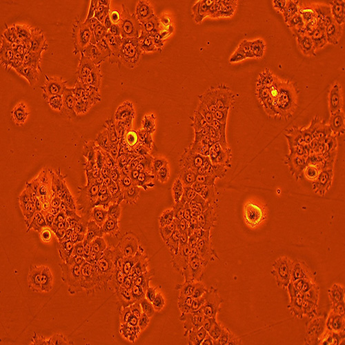 TU212人喉癌细胞（STR鉴定正确）