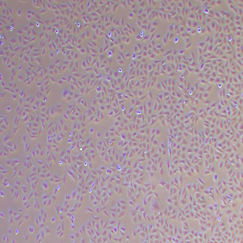 U2OS人骨肉瘤细胞（STR鉴定正确）