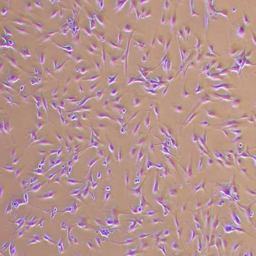 U-87 MG人脑星形胶质母细胞瘤细胞（STR鉴定正确）