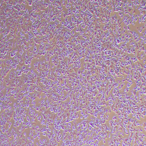 VCaP人前列腺癌细胞（STR鉴定正确）