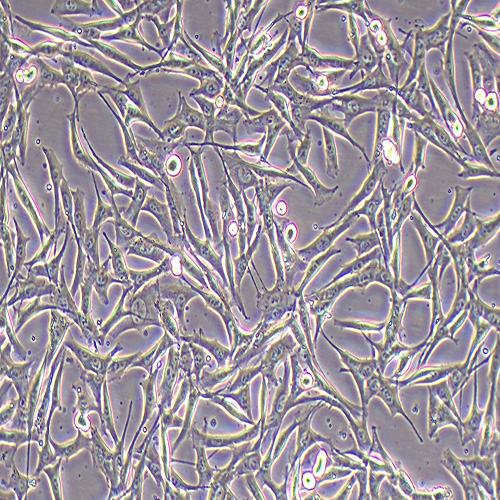 WM-115人恶性黑色素瘤细胞（STR鉴定正确）