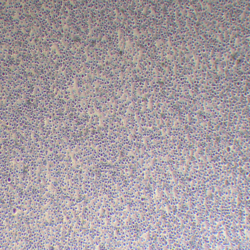 YT人NK细胞白血病细胞（STR鉴定正确）