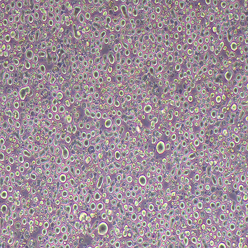 YT人NK细胞白血病细胞（STR鉴定正确）