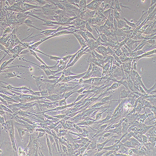 人脂肪干细胞永生化