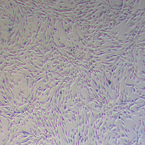 人脂肪干细胞永生化