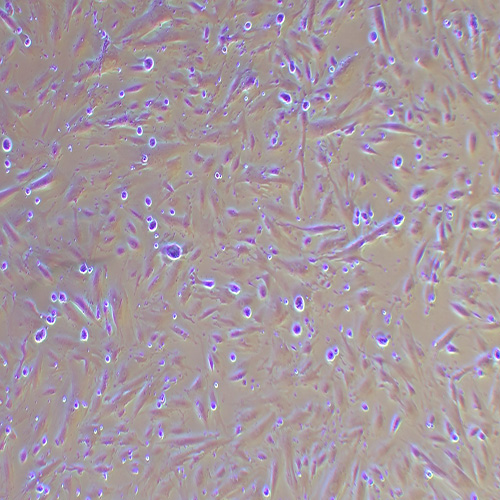 人子宫内膜上皮细胞（永生化）