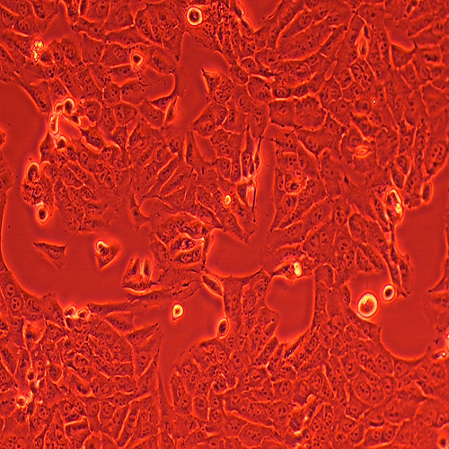 143B-LUC（人骨肉瘤细胞-荧光素酶标记（STR鉴定正确））