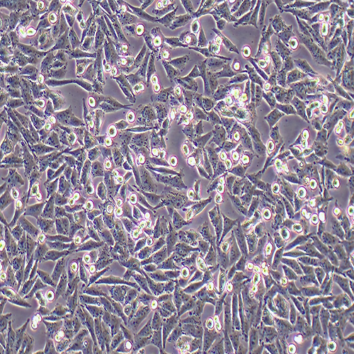 A375-LUC（人恶性黑色素瘤细胞-荧光素酶标记（STR鉴定正确））