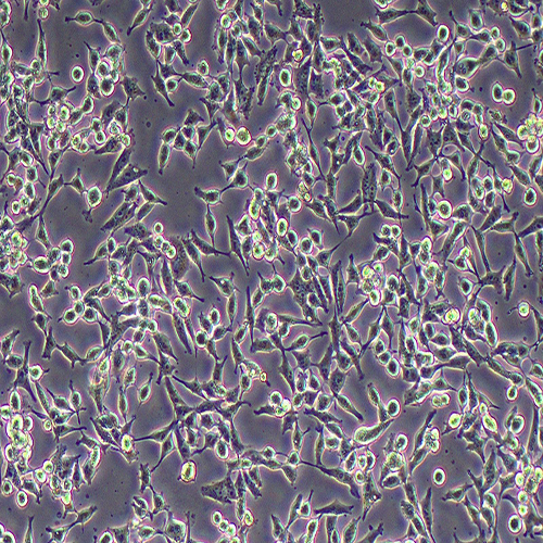 A375-LUC（人恶性黑色素瘤细胞-荧光素酶标记（STR鉴定正确））