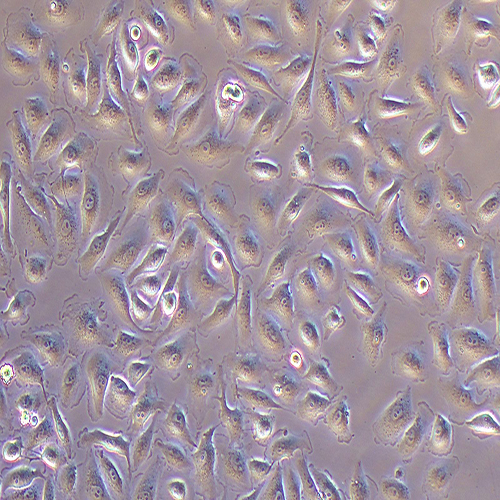 A498-LUC（人肾透明细胞癌-荧光素酶标记（STR鉴定正确））