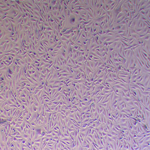 A498-LUC（人肾透明细胞癌-荧光素酶标记（STR鉴定正确））