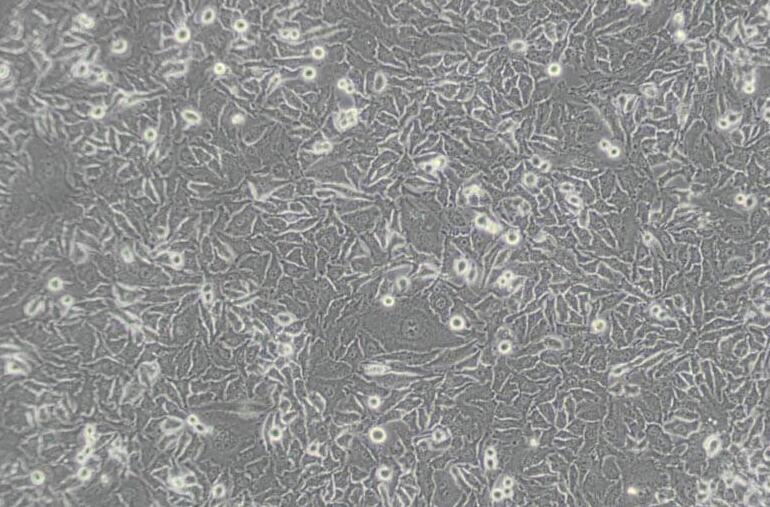 Hela（人宫颈癌细胞）