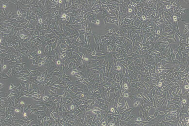 HEp-2（人喉表皮样癌细胞）