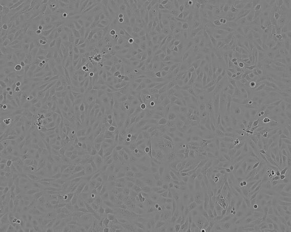 HIC（人小肠癌细胞）