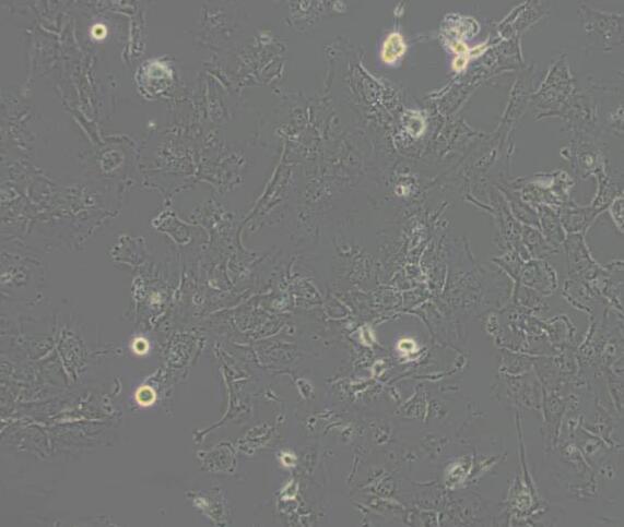 Hs 578T（人乳腺癌细胞）