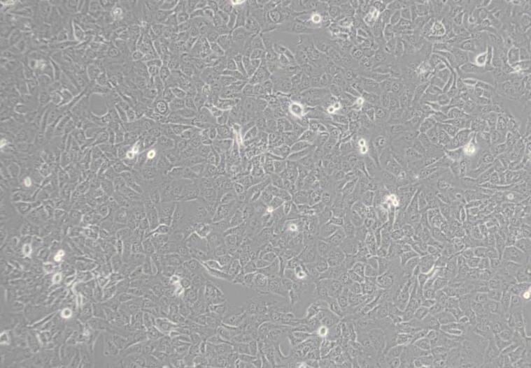 HT-1080 [HT1080]（人纤维肉瘤细胞）