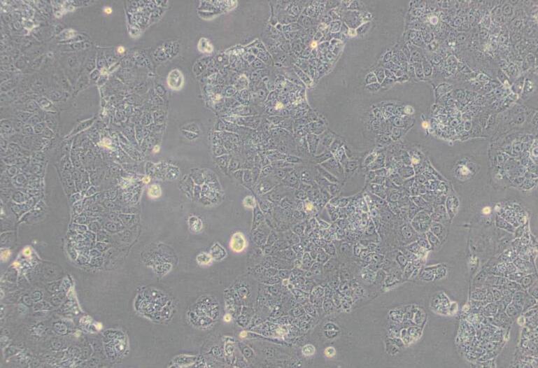 HuH-6（人肝母细胞瘤细胞）