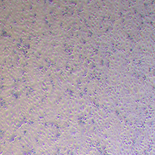 DU145-LUC-PURO（人前列腺癌细胞-荧光素酶标记（STR鉴定正确））