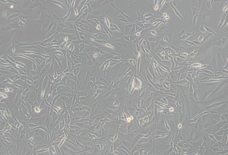 HUV-EC-C [HUVEC]（人脐静脉血管内皮细胞）