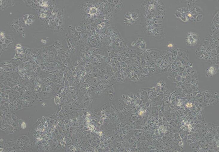 JAR（人胎盘绒毛癌细胞）