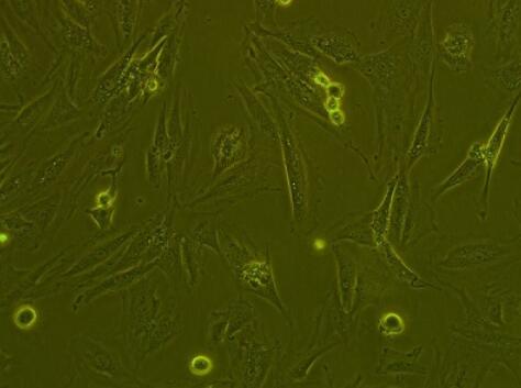 Li-7（人肝癌细胞）