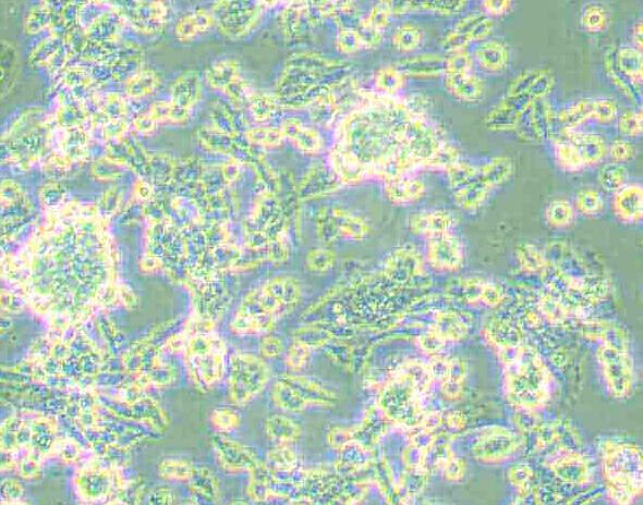 LLC [LL/2; LLC1]（小鼠肺癌细胞）