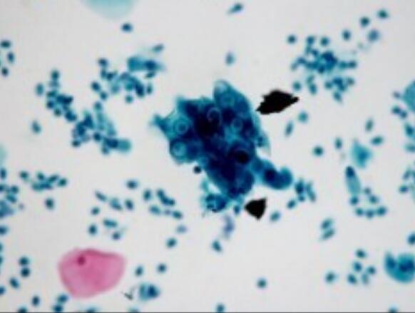 LNCaP clone FGC（人前列腺癌细胞）