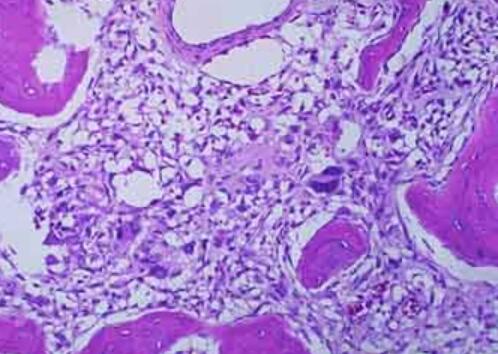 LTEP-a-2（人肺腺癌细胞）