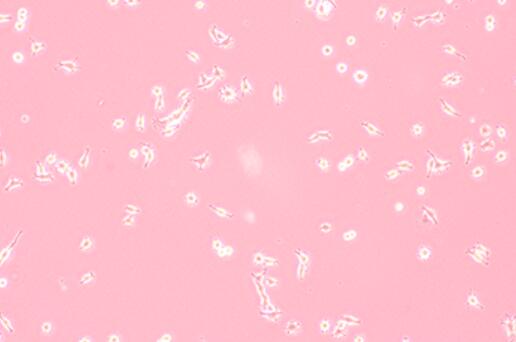 MADB106（大鼠乳腺癌细胞）